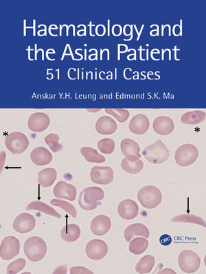 cover image of Haematology and the Asian Patient